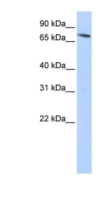 SLC11A2 / DMT1 Antibody (N-Terminus)