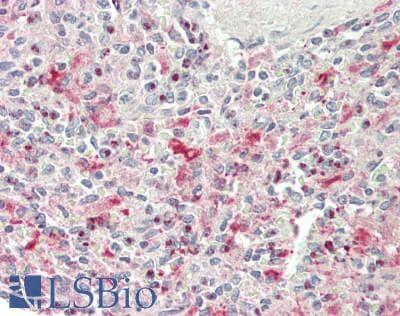 IHC-plus™ Polyclonal Rabbit anti-Human Properdin / CFP Antibody (IHC, IF, WB)