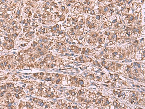 GUSB / Beta Glucuronidase Antibody