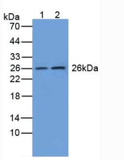 GSTM1 Antibody (aa1-218)