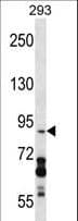DDX20 / GEMIN3 Antibody (aa713-741)