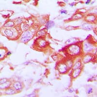 CLDN7 / Claudin 7 Antibody (C-Terminus)