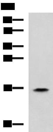 Polyclonal Rabbit anti-Human RPS14 / Ribosomal Protein S14 Antibody (IHC, WB)