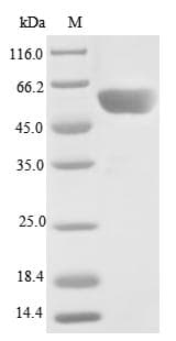Human PPP2R2C Protein (Recombinant 10His, N-terminus + Myc, C-terminus)