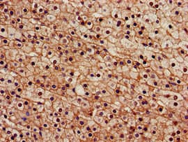 SENP2 Antibody