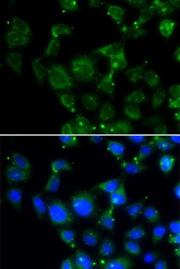 MAPRE2 / EB2 Antibody