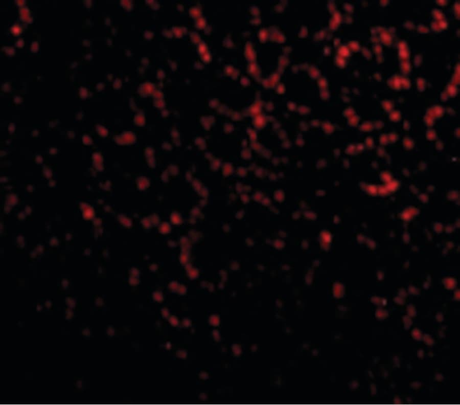 PHAP1 / ANP32A Antibody