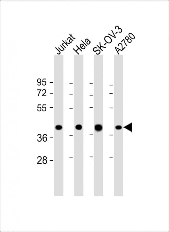 Polyclonal Rabbit anti-Human GBGT1 Antibody (Internal, WB)