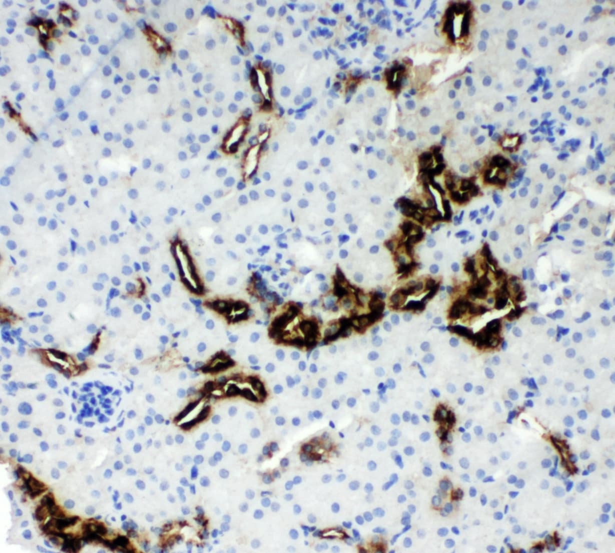 KLK1 / Kallikrein 1 Antibody (aa25-261)