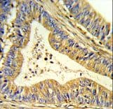 Polyclonal Rabbit anti-Human SOD1 / Cu-Zn SOD Antibody (aa55-84, IHC, IF, WB)