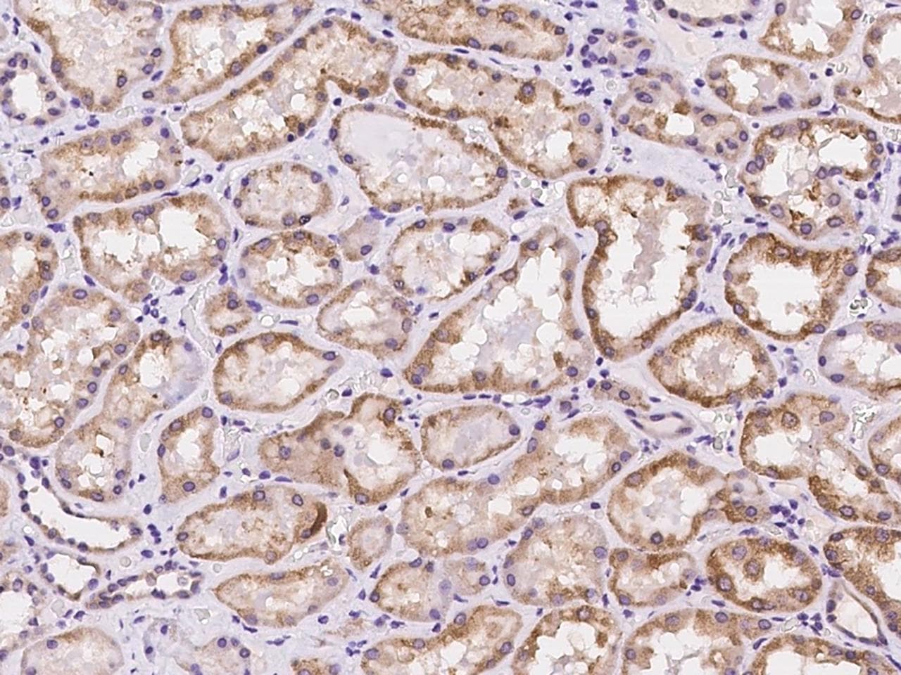 CDKL4 Antibody