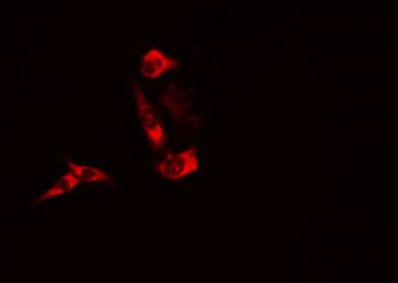 BAD Antibody (phospho-Ser136)
