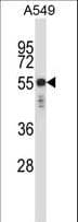 Polyclonal Rabbit anti-Human KRT6C / CK6C / Cytokeratin 6C Antibody (aa135-164, IHC, WB)