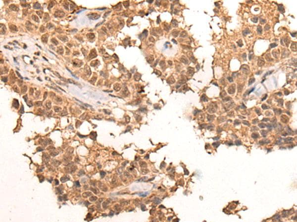 Polyclonal Rabbit anti-Human CLK2 Antibody (IHC)