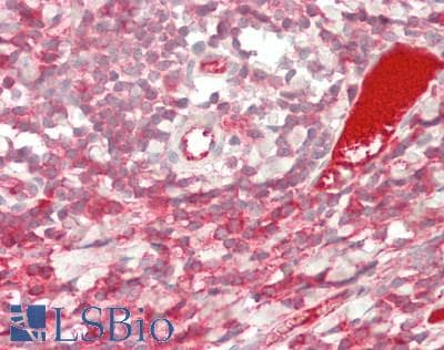 IHC-plus™ Polyclonal Rabbit anti-Human PFK2 / PFKFB3 Antibody (IHC, IF, WB)