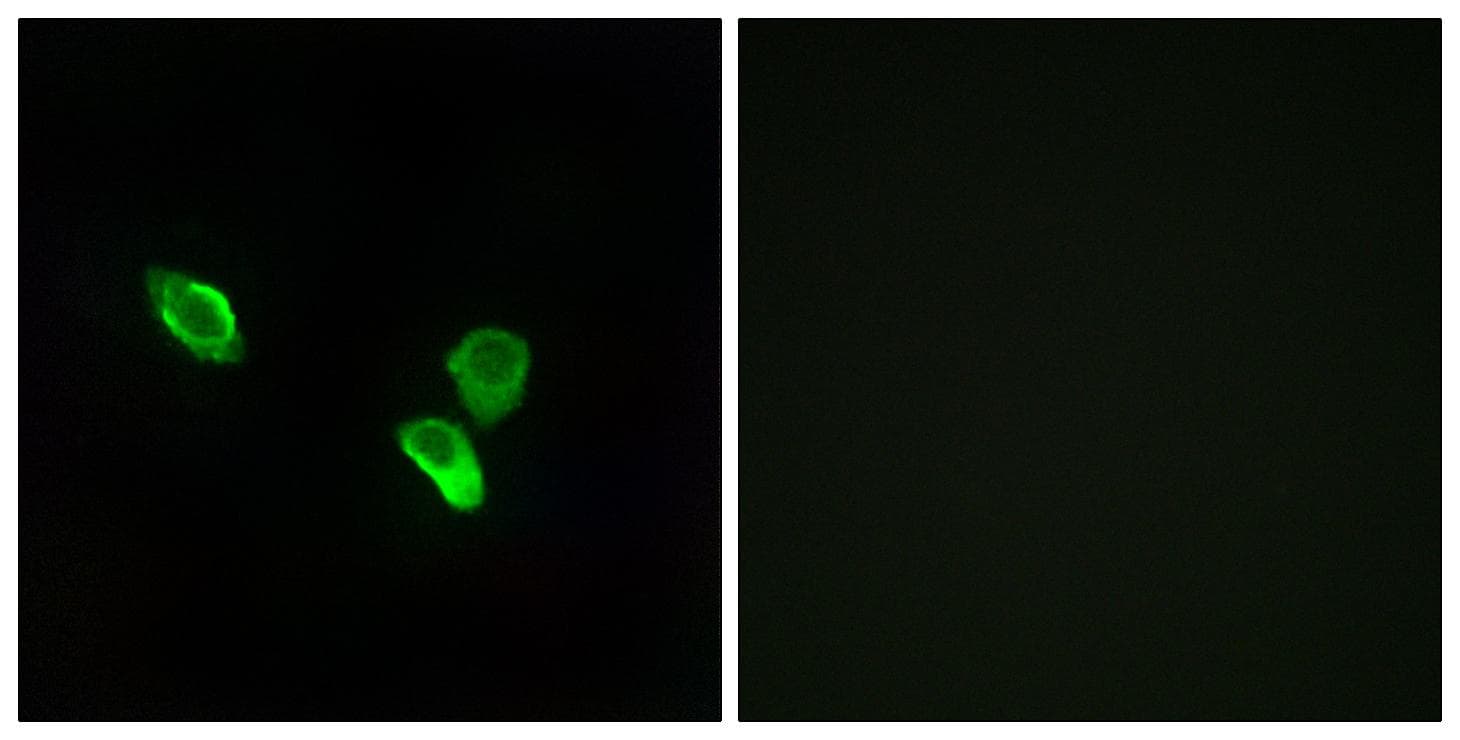 Polyclonal Rabbit anti-Human MRPS18C Antibody (IHC, IF, WB)