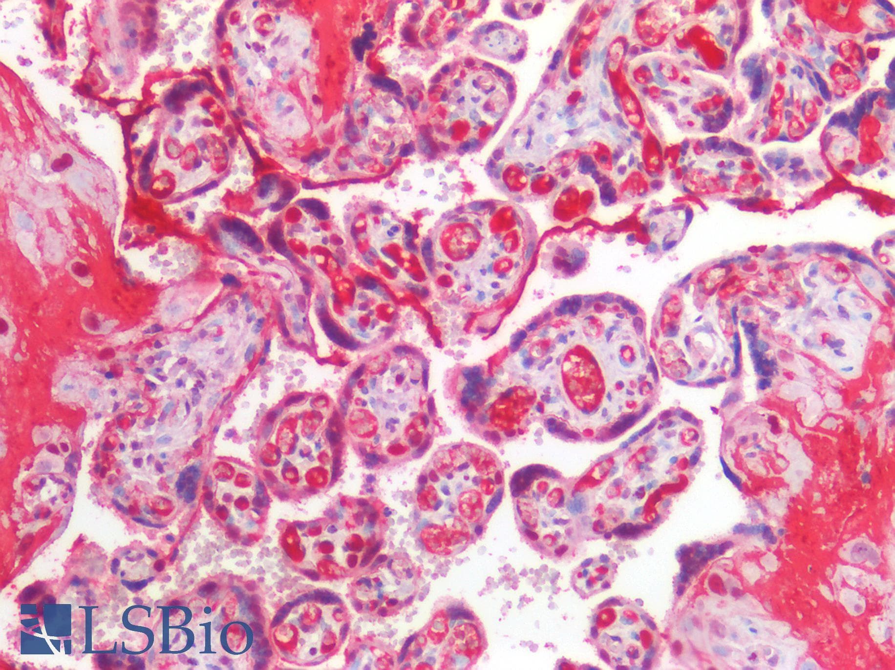 PathPlus™ CCNE1 / Cyclin E1 Antibody (C-Terminus)