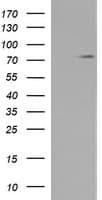 Complement C1s Antibody (clone OTI3B11)