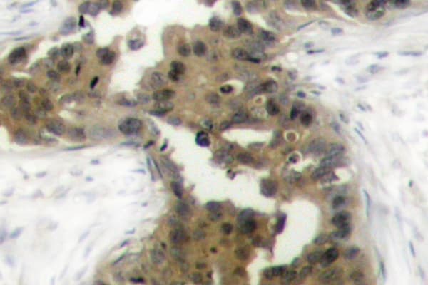 EIF4EBP1 / 4EBP1 Antibody (phospho-Thr37)