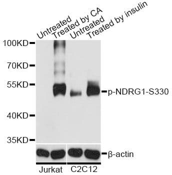 NDRG1 Antibody (phospho-Ser330)