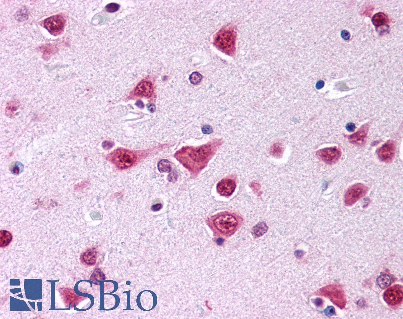 IHC-plus™ Polyclonal Rabbit anti-Human CYP46A1 / CYP46 Antibody (IHC, WB)