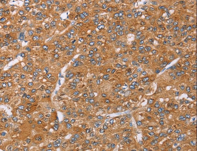 Polyclonal Rabbit anti-Human PAICS / ADE2 Antibody (IHC, WB)