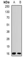 Polyclonal Rabbit anti-Human POP7 Antibody (WB)