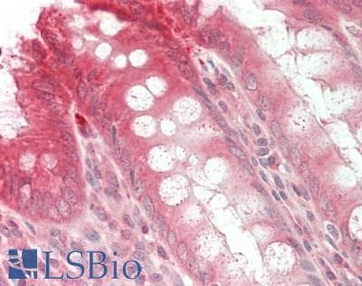 IHC-plus™ BLOC1S1 Antibody