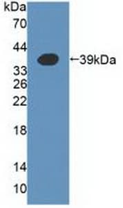 A4GALT Antibody (aa44-353, APC)