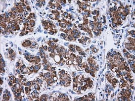 ATP5B / ATP Synthase Beta Antibody (clone OTI7F4)