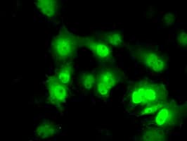 PME-1 / PPME1 Antibody (clone OTI10B2)