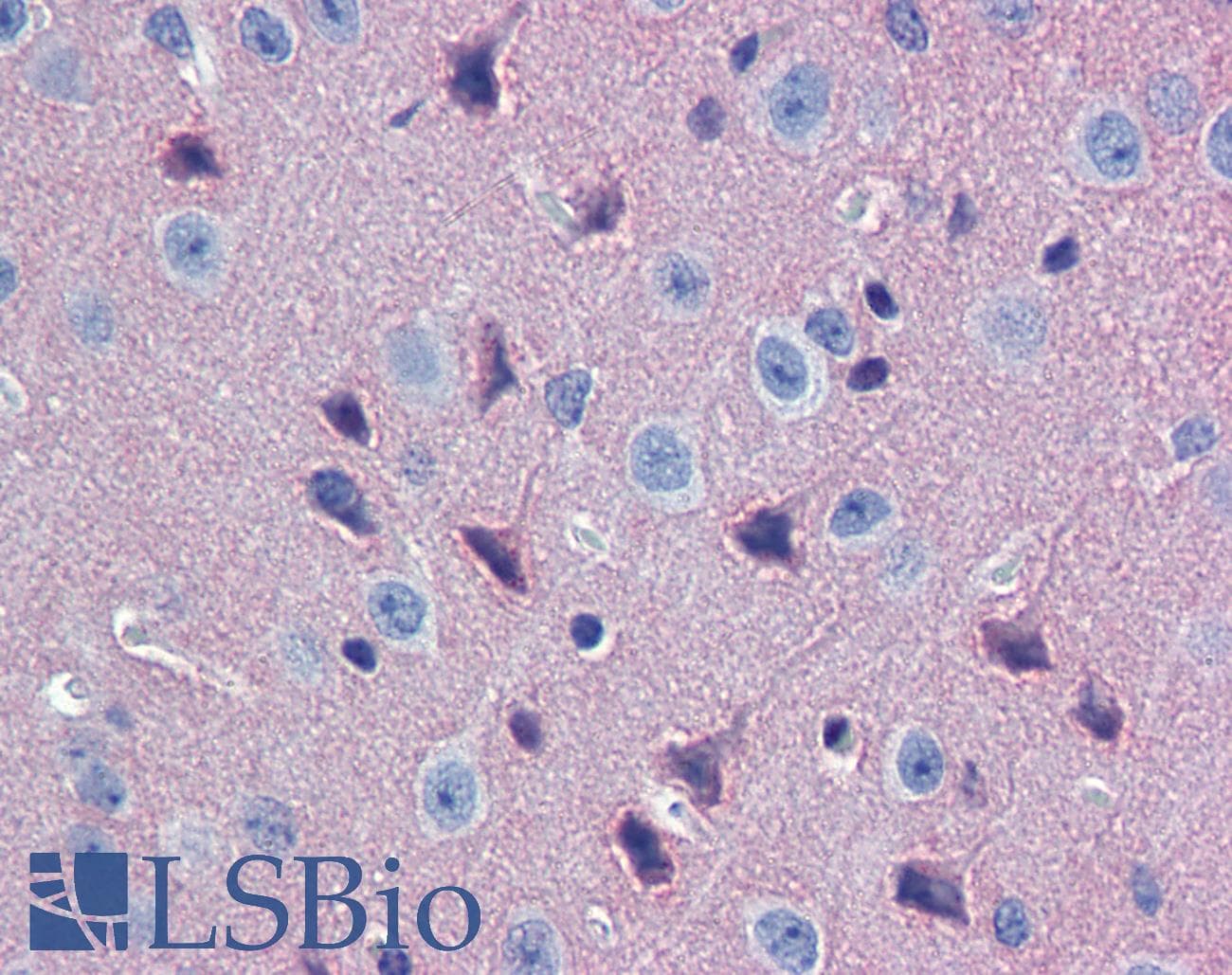 IHC-plus™ Polyclonal Rabbit anti-Mouse GNAO1 Antibody (aa345-354, IHC, WB)