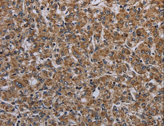MYO7A / Myosin-VIIa Antibody