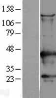 Human CAMK1 / CAMKI Protein (Over-Expression Lysate Myc-DDK (Flag))