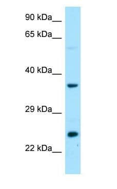 Polyclonal Rabbit anti-Human DTD1 Antibody (C-Terminus, WB)