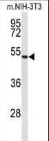 Polyclonal Rabbit anti-Human FBLN4 / EFEMP2 Antibody (aa386-414, WB)