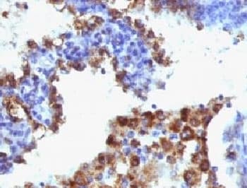 NAPSA / NAPA / Napsin A Antibody (clone NAPSA/1238 + NAPSA/1239, Ready-to-Use)