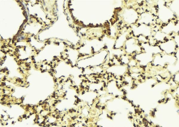 BCL2L10 / Diva Antibody