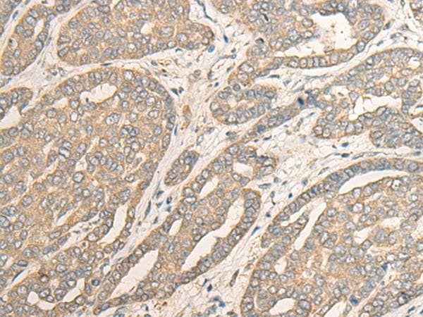 Polyclonal Rabbit anti-Human MYOZ2 / CS-1 Antibody (IHC)