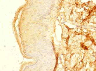 Polyclonal Rabbit anti-Human ZNF513 Antibody