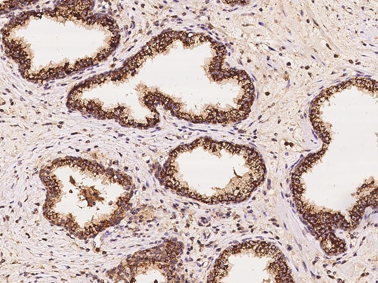 ARG2 / Arginase 2 Antibody