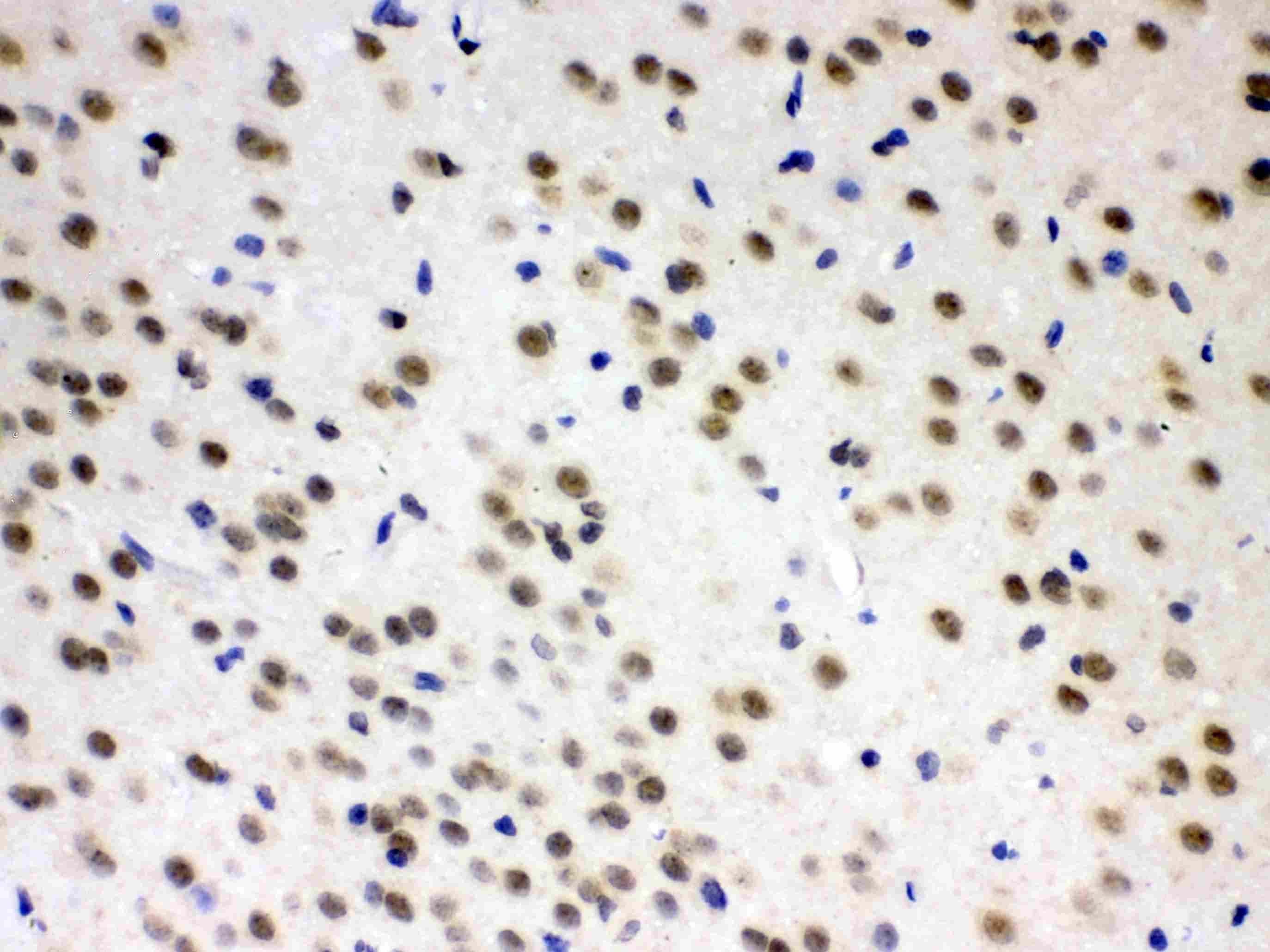 AZIN2 / Antizyme Inhibitor 2 Antibody