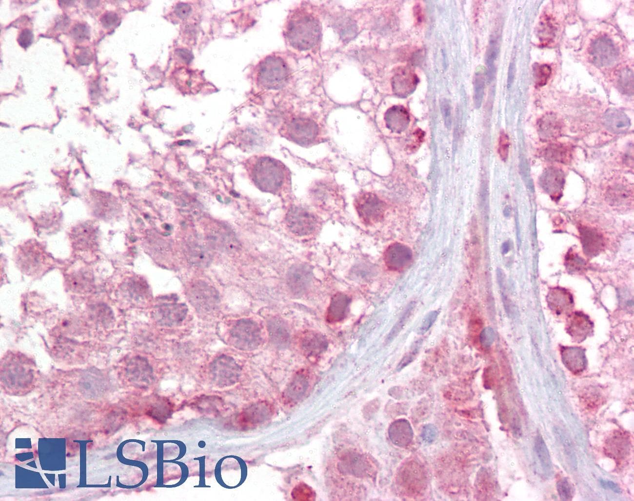 PathPlus™ LMX1B Antibody (aa87-100)