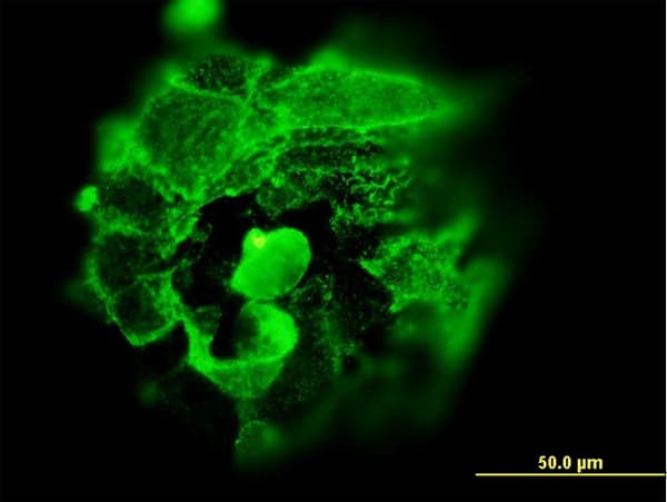 Monoclonal Mouse anti-Human TP53 / p53 Antibody (clone 2C3, IF, WB)