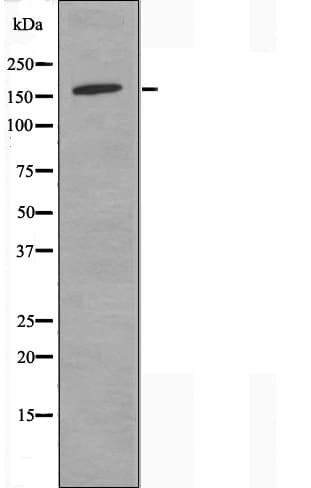 COL4A2 / Collagen IV Alpha2 Antibody