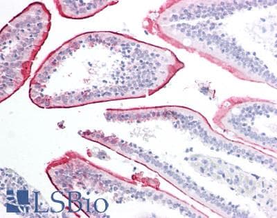 IHC-plus™ VPS45 Antibody (aa558-570)