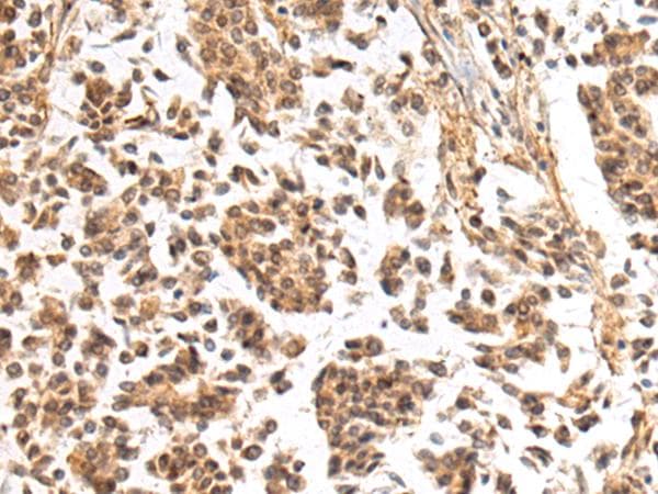 NHLRC2 Antibody
