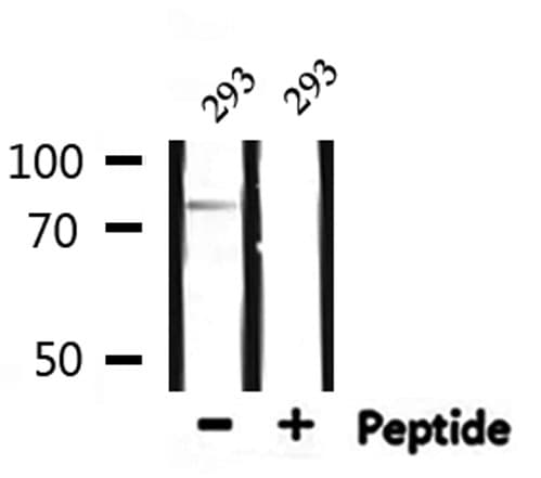 MYST2 / HBO1 Antibody