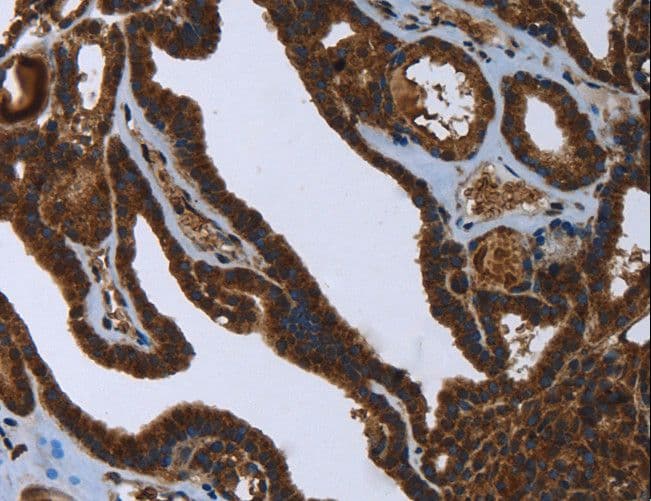 Polyclonal Rabbit anti-Human FASTKD2 Antibody (IHC, WB)