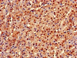CYP-M / CYP20A1 Antibody